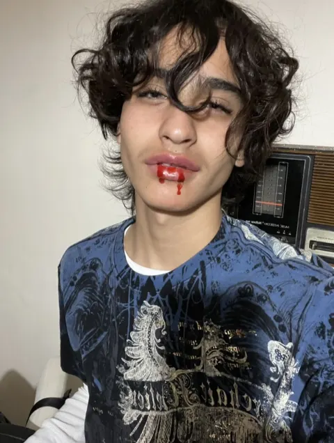 Jovem com sangue falso